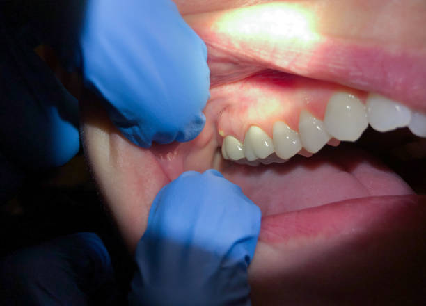 Professional Emergency Dentist in DE