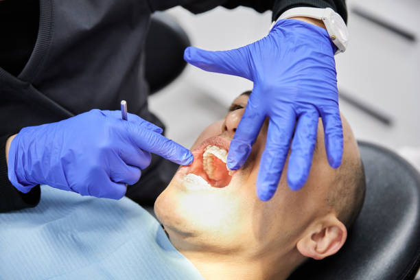 Best Dentist for Tooth Abscess  in Claymont, DE